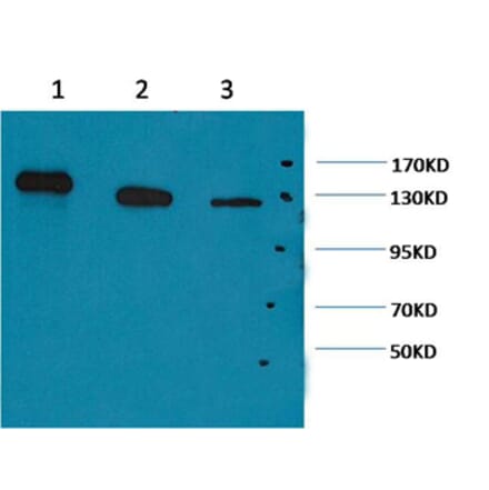 Western blot - PARP Mouse Monoclonal Antibody from Signalway Antibody (38067) - Antibodies.com