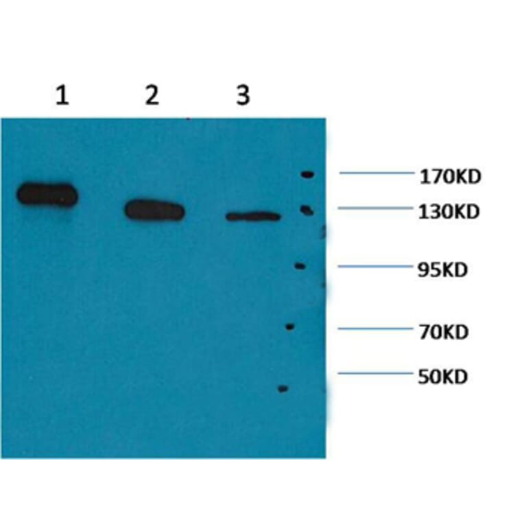 Western blot - PARP Mouse Monoclonal Antibody from Signalway Antibody (38067) - Antibodies.com