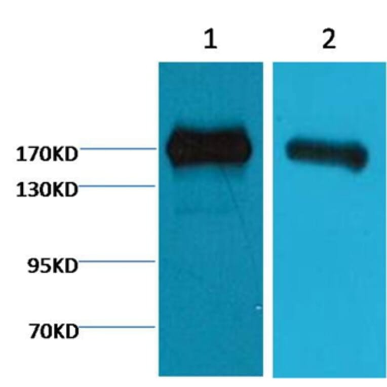 Western blot - EGFR Mouse Monoclonal Antibody from Signalway Antibody (38070) - Antibodies.com
