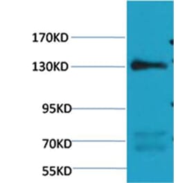 Western blot - eNOS Mouse Monoclonal Antibody from Signalway Antibody (38100) - Antibodies.com