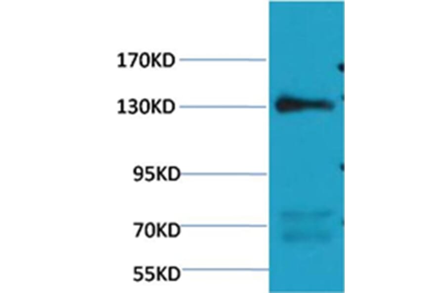 Western blot - eNOS Mouse Monoclonal Antibody from Signalway Antibody (38100) - Antibodies.com