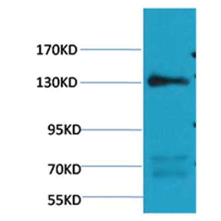 Western blot - eNOS Mouse Monoclonal Antibody from Signalway Antibody (38100) - Antibodies.com