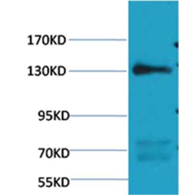 Western blot - eNOS Mouse Monoclonal Antibody from Signalway Antibody (38100) - Antibodies.com