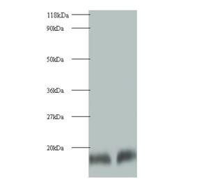 Cystatin-B Polyclonal Antibody from Signalway Antibody (42074) - Antibodies.com