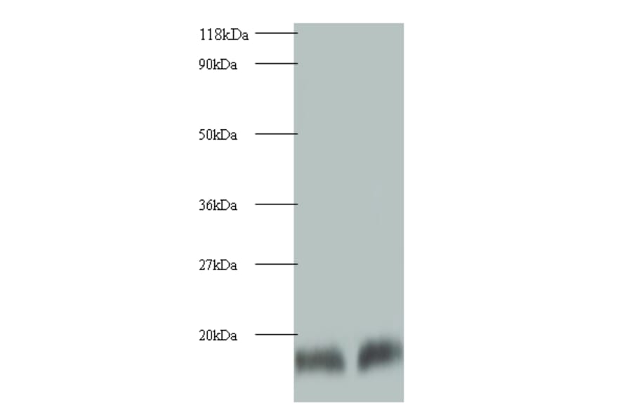 Cystatin-B Polyclonal Antibody from Signalway Antibody (42074) - Antibodies.com