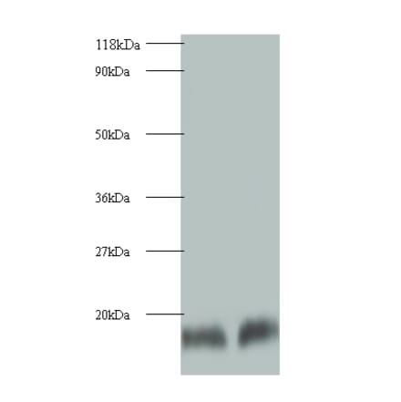 Cystatin-B Polyclonal Antibody from Signalway Antibody (42074) - Antibodies.com