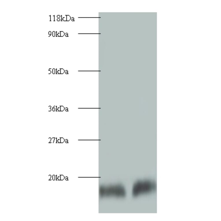 Cystatin-B Polyclonal Antibody from Signalway Antibody (42074) - Antibodies.com