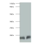 Cystatin-B Polyclonal Antibody from Signalway Antibody (42074) - Antibodies.com
