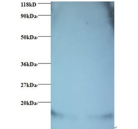 Hemoglobin Polyclonal Antibody from Signalway Antibody (42107) - Antibodies.com