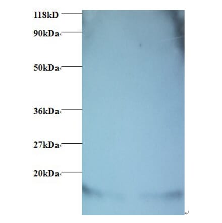 Hemoglobin Polyclonal Antibody from Signalway Antibody (42107) - Antibodies.com