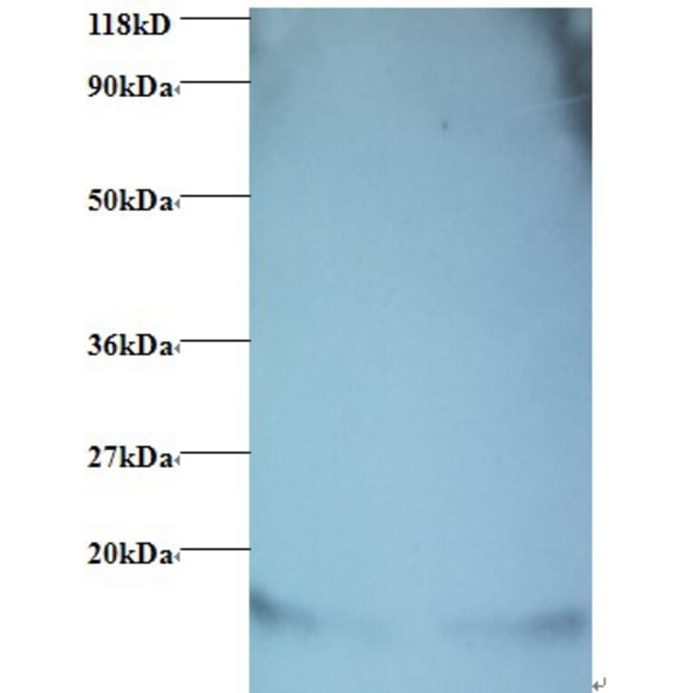 Hemoglobin Polyclonal Antibody from Signalway Antibody (42107) - Antibodies.com