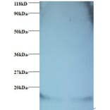 Hemoglobin Polyclonal Antibody from Signalway Antibody (42107) - Antibodies.com