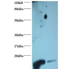 Hemoglobin Polyclonal Antibody from Signalway Antibody (42108) - Antibodies.com