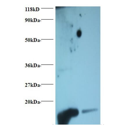 Hemoglobin Polyclonal Antibody from Signalway Antibody (42108) - Antibodies.com