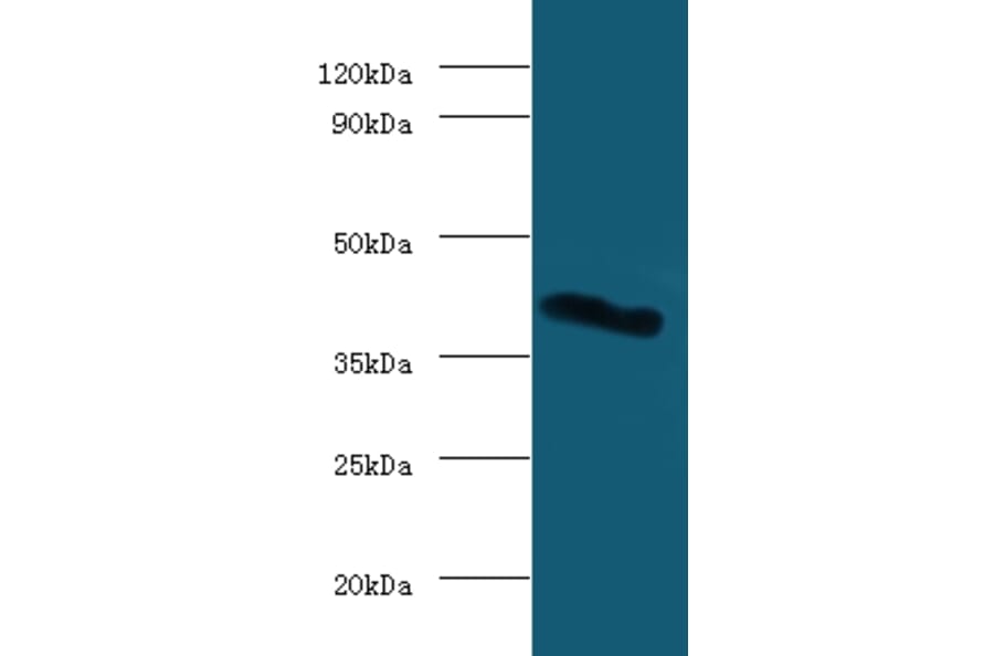Galectin-9 Polyclonal Antibody from Signalway Antibody (42368) - Antibodies.com