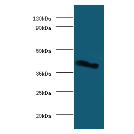 Galectin-9 Polyclonal Antibody from Signalway Antibody (42368) - Antibodies.com