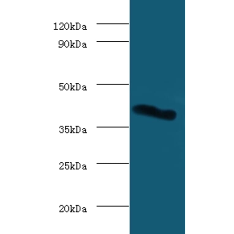 Galectin-9 Polyclonal Antibody from Signalway Antibody (42368) - Antibodies.com