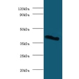 Galectin-9 Polyclonal Antibody from Signalway Antibody (42368) - Antibodies.com