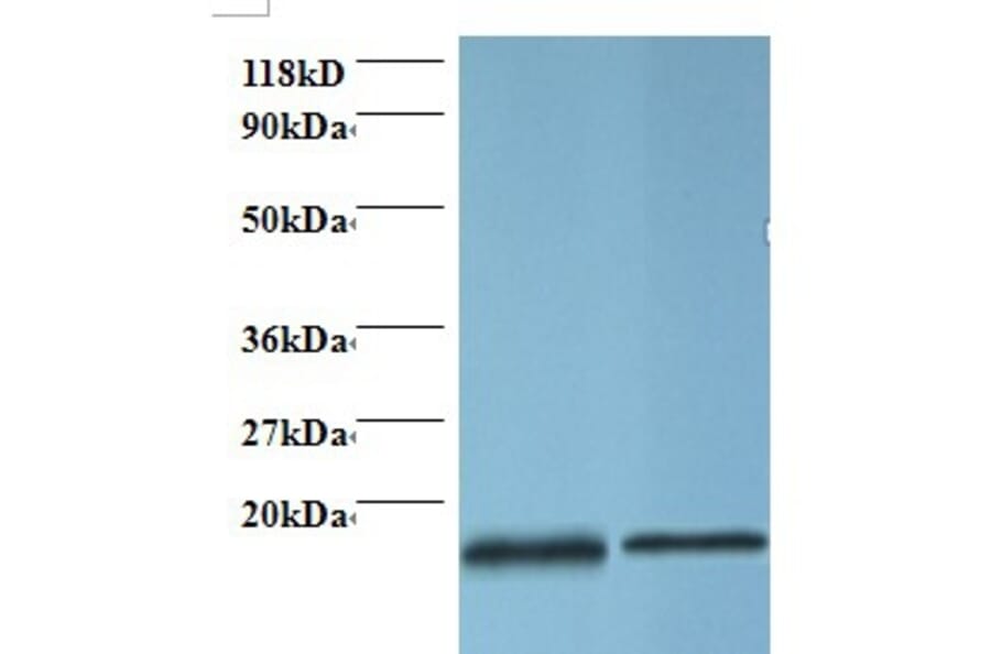 Profilin-1 Polyclonal Antibody from Signalway Antibody (42410) - Antibodies.com