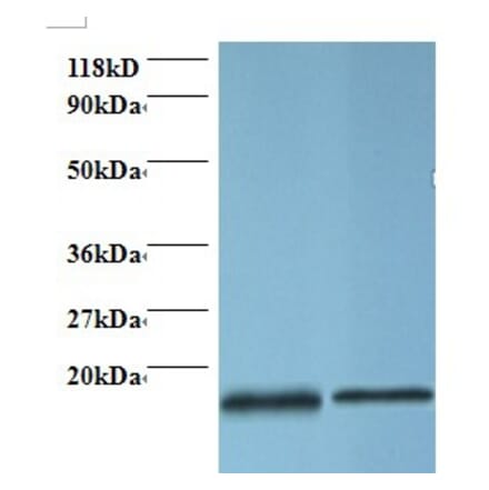 Profilin-1 Polyclonal Antibody from Signalway Antibody (42410) - Antibodies.com