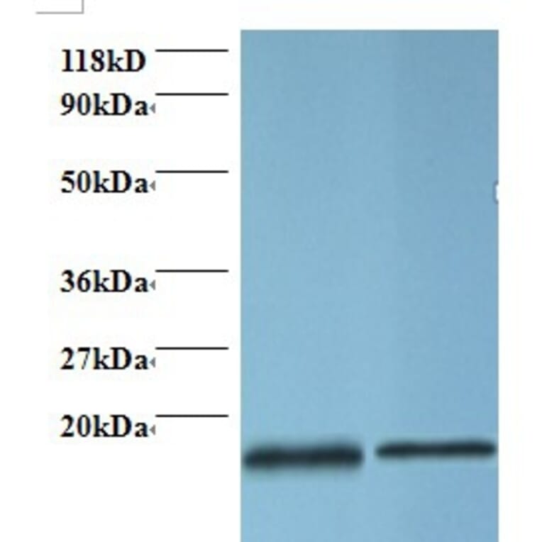 Profilin-1 Polyclonal Antibody from Signalway Antibody (42410) - Antibodies.com