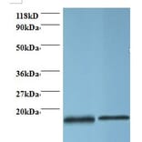 Profilin-1 Polyclonal Antibody from Signalway Antibody (42410) - Antibodies.com