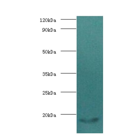 Calmodulin Polyclonal Antibody from Signalway Antibody (42501) - Antibodies.com