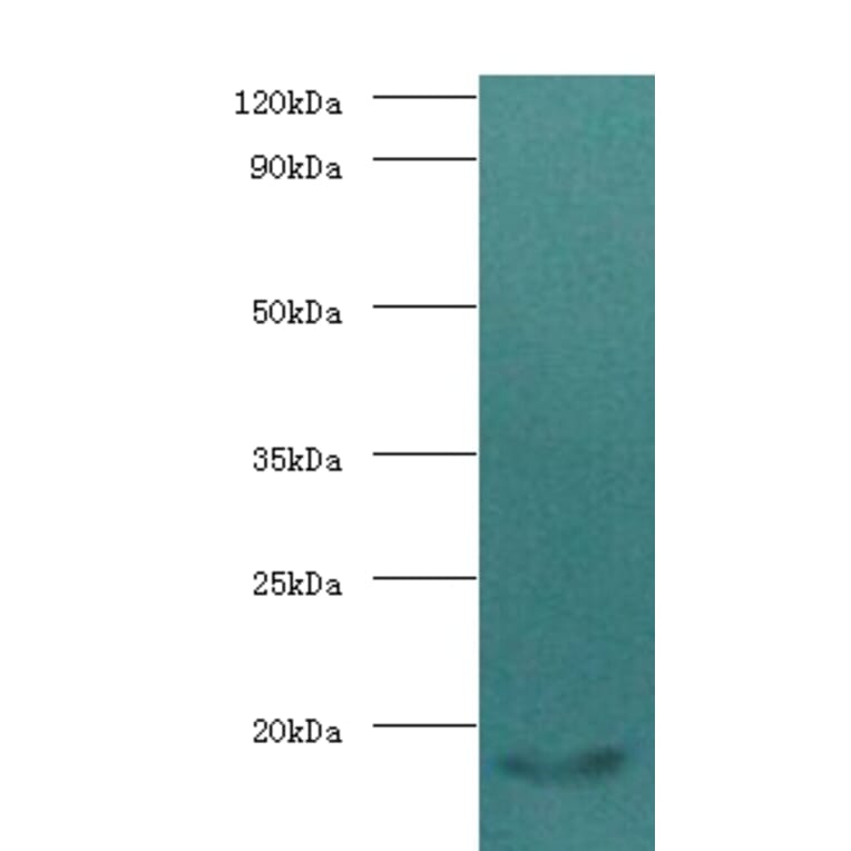 Calmodulin Polyclonal Antibody from Signalway Antibody (42501) - Antibodies.com