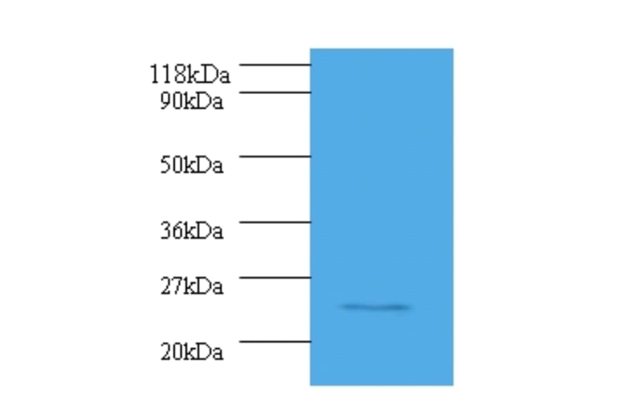 Serine/arginine-rich splicing factor 9 Polyclonal Antibody from Signalway Antibody (42073) - Antibodies.com