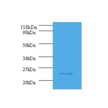 Serine/arginine-rich splicing factor 9 Polyclonal Antibody from Signalway Antibody (42073) - Antibodies.com