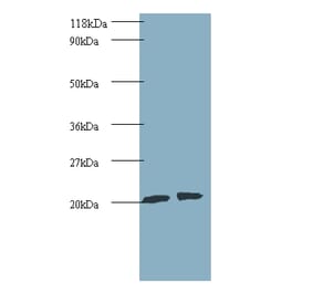 ADP-ribosylation factor-like protein 2 Polyclonal Antibody from Signalway Antibody (42235) - Antibodies.com