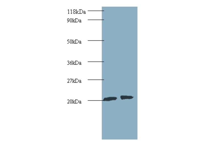 ADP-ribosylation factor-like protein 2 Polyclonal Antibody from Signalway Antibody (42235) - Antibodies.com