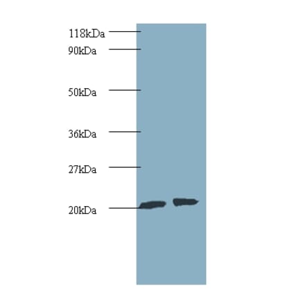 ADP-ribosylation factor-like protein 2 Polyclonal Antibody from Signalway Antibody (42235) - Antibodies.com