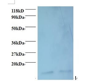 Macrophage migration inhibitory factor Polyclonal Antibody from Signalway Antibody (42468) - Antibodies.com