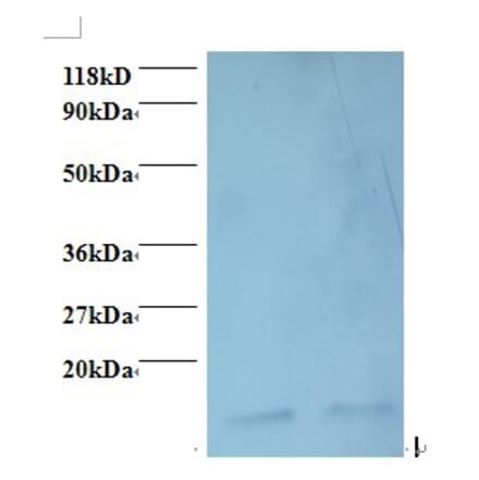 Macrophage migration inhibitory factor Polyclonal Antibody from Signalway Antibody (42468) - Antibodies.com