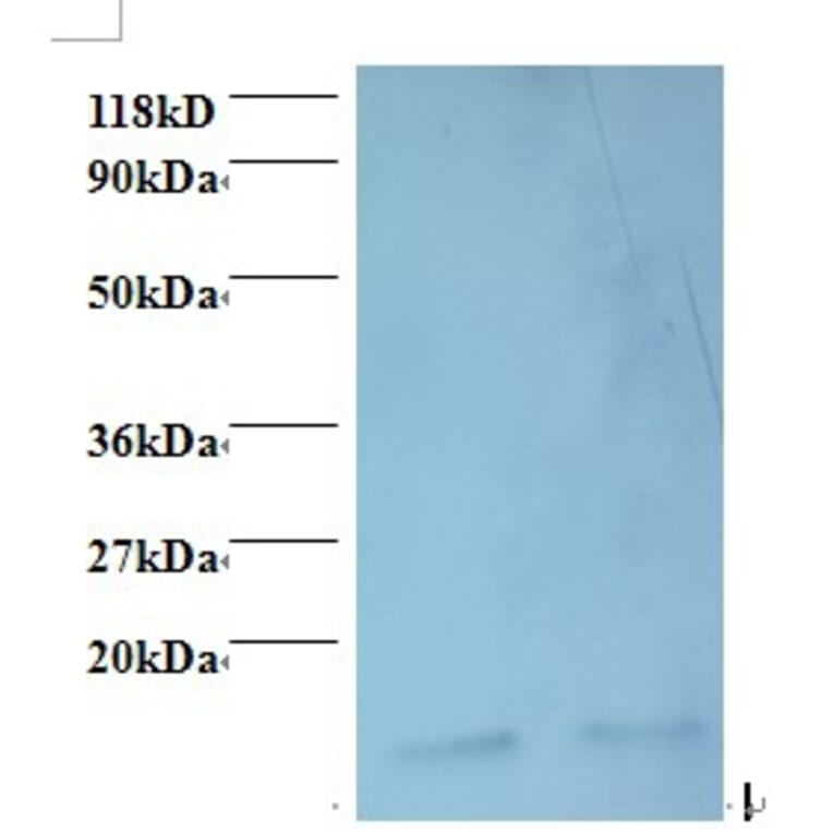 Macrophage migration inhibitory factor Polyclonal Antibody from Signalway Antibody (42468) - Antibodies.com