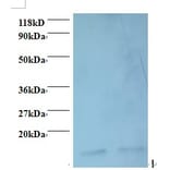 Macrophage migration inhibitory factor Polyclonal Antibody from Signalway Antibody (42468) - Antibodies.com
