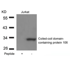 Western blot - Coiled-coil domain-containing protein 106 Antibody from Signalway Antibody (21412) - Antibodies.com