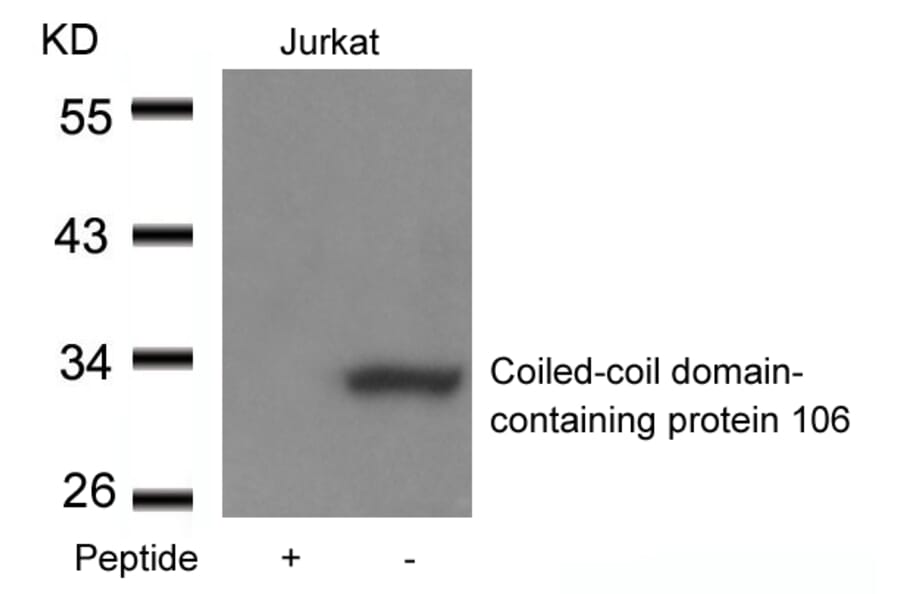 Western blot - Coiled-coil domain-containing protein 106 Antibody from Signalway Antibody (21412) - Antibodies.com