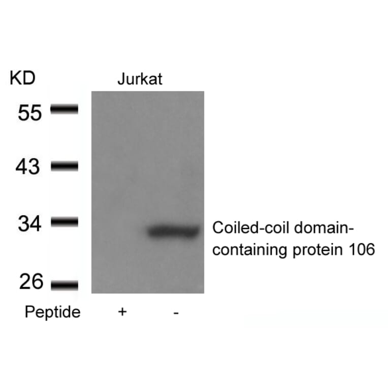 Western blot - Coiled-coil domain-containing protein 106 Antibody from Signalway Antibody (21412) - Antibodies.com