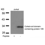 Western blot - Coiled-coil domain-containing protein 106 Antibody from Signalway Antibody (21412) - Antibodies.com