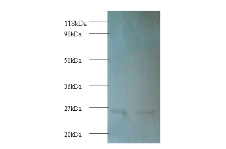 Proteasome subunit beta type-1 Polyclonal Antibody from Signalway Antibody (42253) - Antibodies.com