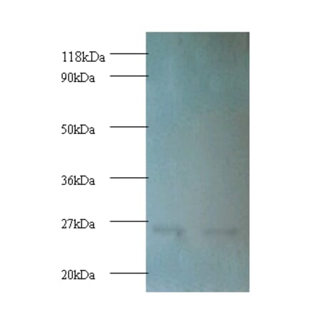 Proteasome subunit beta type-1 Polyclonal Antibody from Signalway Antibody (42253) - Antibodies.com