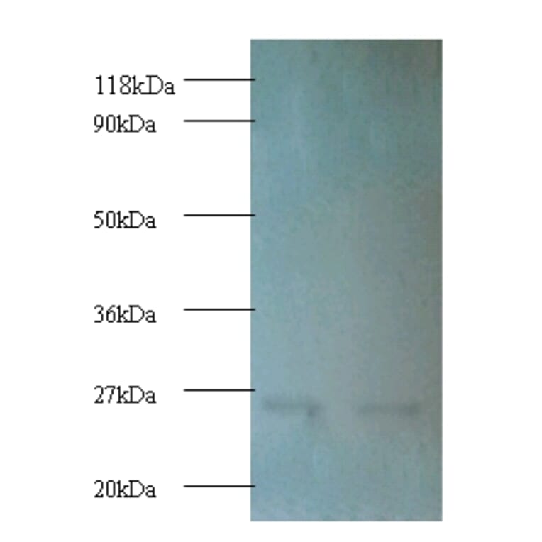 Proteasome subunit beta type-1 Polyclonal Antibody from Signalway Antibody (42253) - Antibodies.com