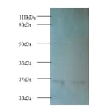 Proteasome subunit beta type-1 Polyclonal Antibody from Signalway Antibody (42253) - Antibodies.com