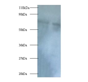 Polycomb complex protein BMI-1 Polyclonal Antibody from Signalway Antibody (42391) - Antibodies.com