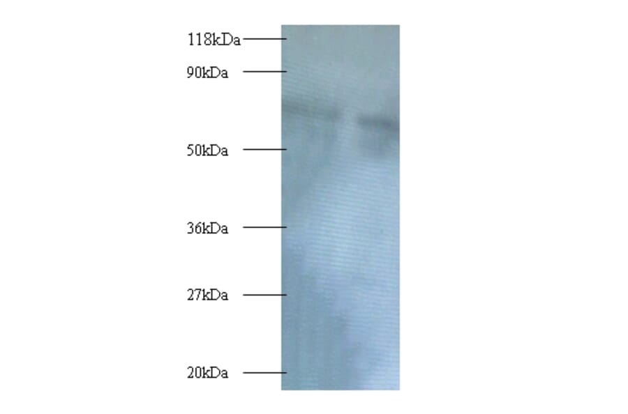 Polycomb complex protein BMI-1 Polyclonal Antibody from Signalway Antibody (42391) - Antibodies.com