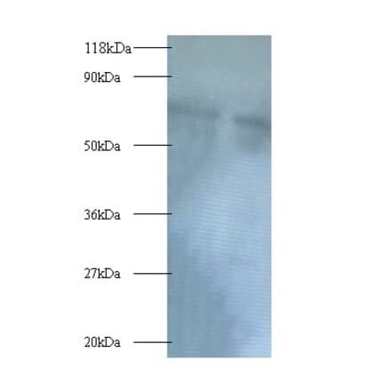 Polycomb complex protein BMI-1 Polyclonal Antibody from Signalway Antibody (42391) - Antibodies.com