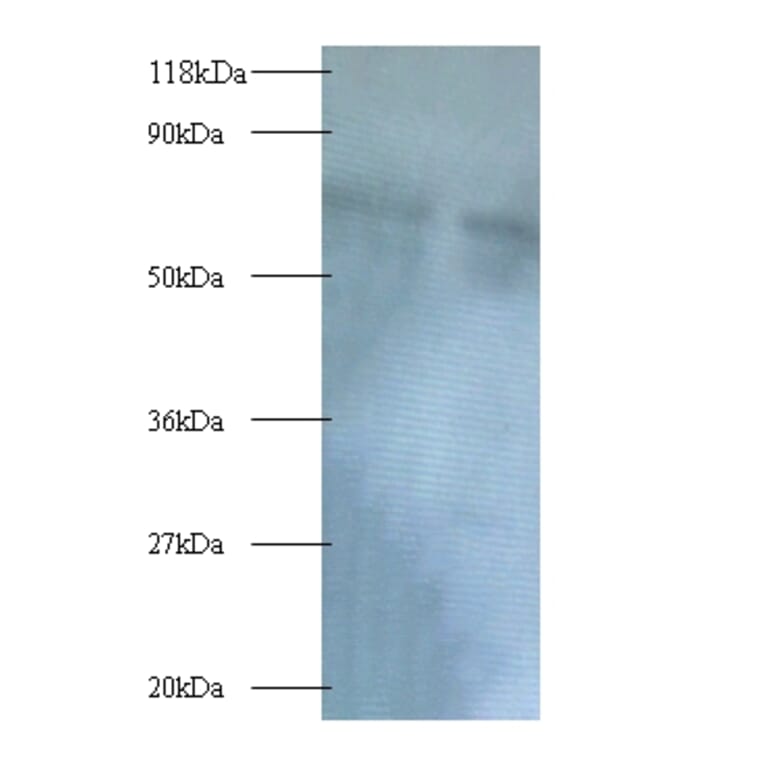 Polycomb complex protein BMI-1 Polyclonal Antibody from Signalway Antibody (42391) - Antibodies.com