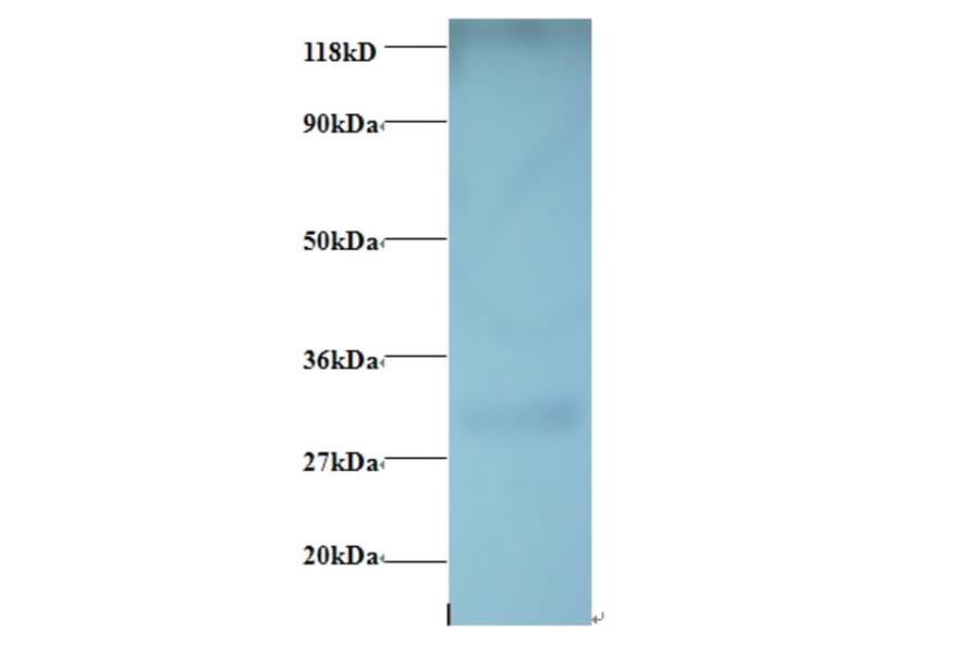 G-protein coupled receptor 161 Polyclonal Antibody from Signalway Antibody (42408) - Antibodies.com
